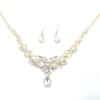 Wild clavicle chain